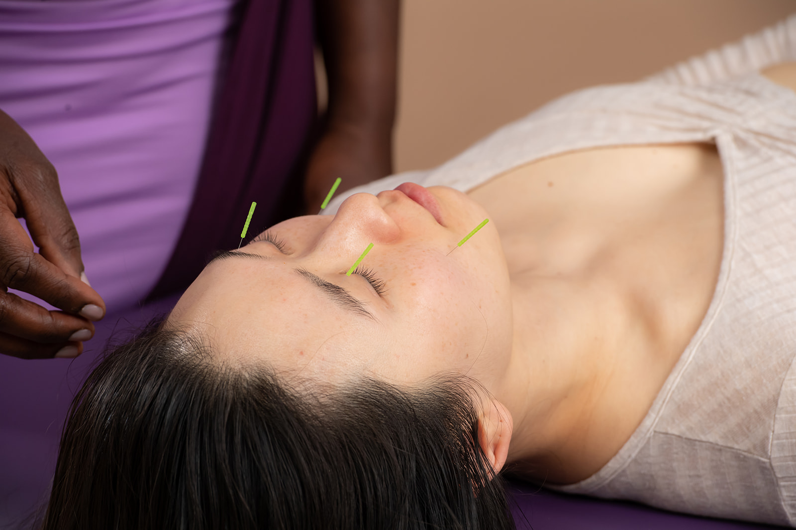 Acupuncture Services