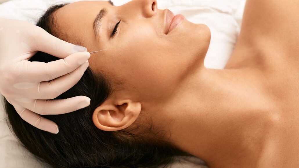 Acupuncture and Fertility: Patient relaxing during acupuncture session aimed at fertility improvement