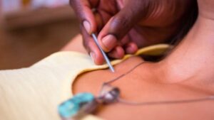 Perimenopause Bloating: Why It Happens and Holistic Remedies 1 2 ACUPUNCTURE